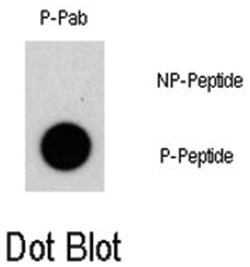 NR4A1 (phospho S351), Rabbit anti-Human, Polyclonal Antibody, Abnova 400&mu;L;