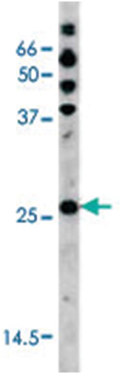 CDKN1B (phospho S178), Rabbit anti-Human, Polyclonal Antibody, Abnova 400 &mu;L | Buy Online | Abnova Corporation | Fisher Scientific