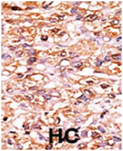 CDKN1B (phospho S178), Rabbit anti-Human, Polyclonal Antibody, Abnova 400 &mu;L | Buy Online | Abnova Corporation | Fisher Scientific