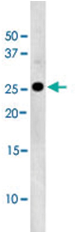 CDKN1B (phospho T157), Rabbit anti-Human, Polyclonal Antibody, Abnova 400&mu;L;