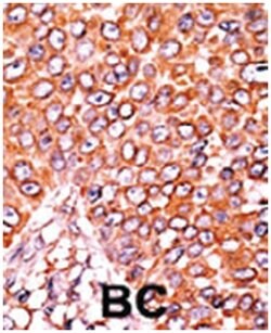 CDKN1B (phospho T157), Rabbit anti-Human, Polyclonal Antibody, Abnova 400&mu;L;