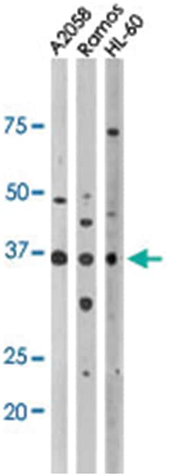 TP53 (phospho T18), Rabbit anti-Human, Mouse, Polyclonal Antibody, Abnova