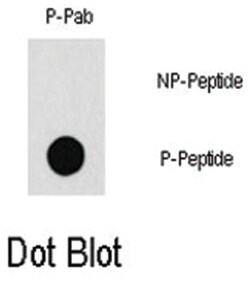 PAK1 (phospho T212), Rabbit anti-Human, Polyclonal Antibody, Abnova 400&mu;L;