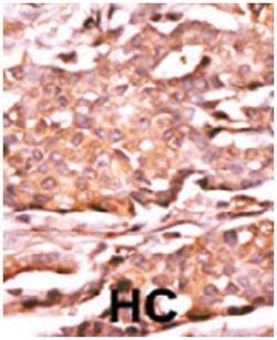 RAD9A (phospho S272), Rabbit anti-Human, Polyclonal Antibody, Abnova 400&mu;L;