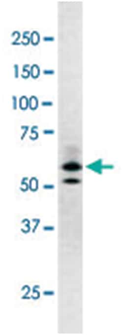 RAD9A (phospho S277), Rabbit anti-Human, Polyclonal Antibody, Abnova 400&mu;L;