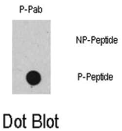 RAF1 (phospho S471), Rabbit anti-Human, Polyclonal Antibody, Abnova 400&mu;L;