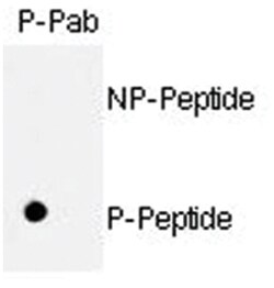 RB1 (phospho S811), Rabbit anti-Human, Polyclonal Antibody, Abnova 400&mu;L;