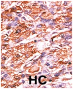 RB1 (phospho S811), Rabbit anti-Human, Polyclonal Antibody, Abnova 400&mu;L;