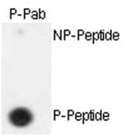 ESPL1 (phospho S1126), Rabbit anti-Human, Polyclonal Antibody, Abnova 400&mu;L;
