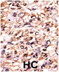 ESPL1 (phospho S1126), Rabbit anti-Human, Polyclonal Antibody, Abnova 400&mu;L;