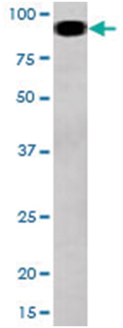 STAT5A (phospho S726), Rabbit anti-Human, Polyclonal Antibody, Abnova 400&mu;L;
