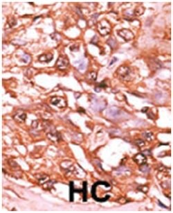 STAT5A (phospho S726), Rabbit anti-Human, Polyclonal Antibody, Abnova 400&mu;L;