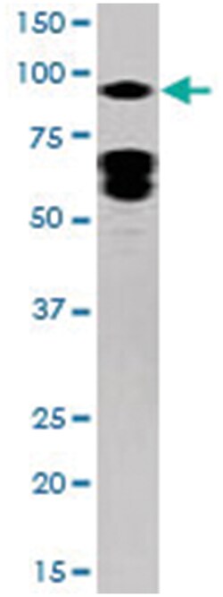 STAT5A (phospho Y694), Rabbit anti-Human, Polyclonal Antibody, Abnova 400&mu;L;