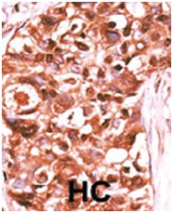 STAT5A (phospho Y694), Rabbit anti-Human, Polyclonal Antibody, Abnova 400&mu;L;