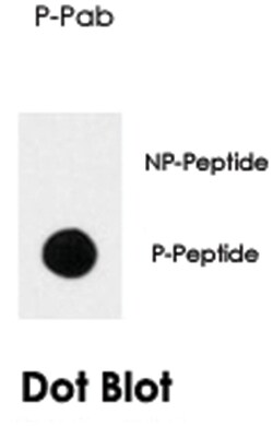 NTRK1 (phospho Y791), Rabbit anti-Human, Polyclonal Antibody, Abnova 400 &mu;L | Buy Online | Abnova Corporation | Fisher Scientific