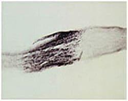 NTF3 Rabbit anti-Chicken, Human, Rat, Polyclonal Antibody, Abnova 100&mu;L;