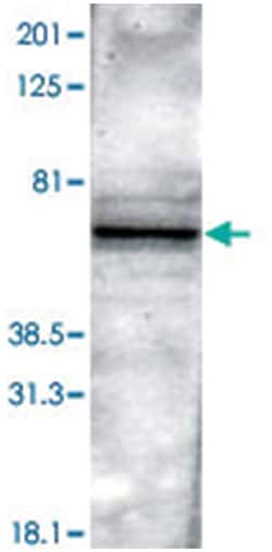 PTH2R Rabbit anti-Rat, Polyclonal Antibody, Abnova 100&mu;L; Unlabeled:Antibodies,
