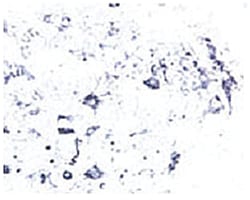 Ntrk2, Rabbit, Polyclonal Antibody, Abnova 100&mu;L; Unlabeled:Antibodies,