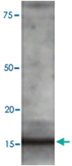 MAP1LC3B Rabbit anti-Human, Rat, Polyclonal Antibody, Abnova 100&mu;L;