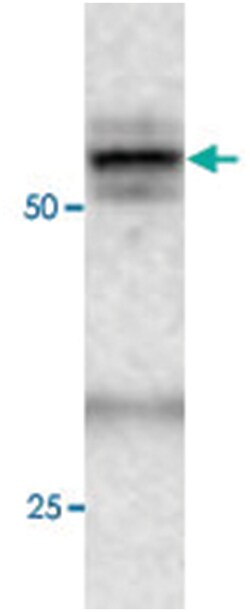 ATG4C, Rabbit, Polyclonal Antibody, Abnova 100&mu;L; Unlabeled:Antibodies,