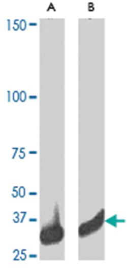 CDC2 Rabbit anti-Human, Mouse, Rat, Polyclonal Antibody, Abnova 200&mu;g;