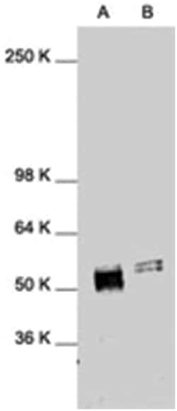 FOS Rabbit anti-Human, Mouse, Rat, Polyclonal Antibody, Abnova 200&mu;g;
