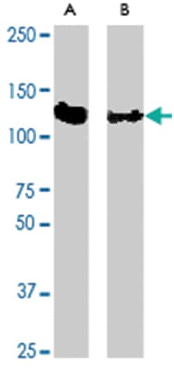 CBL Rabbit anti-Human, Mouse, Rat, Polyclonal Antibody, Abnova 200&mu;g;