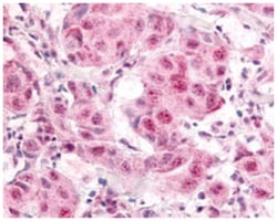 E2F1 (phospho S364), Rabbit, Polyclonal Antibody, Abnova 100&mu;g; Unlabeled:Antibodies,