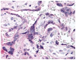 EGFR (phospho Y1197), Rabbit anti-Human, Mouse, Rat, Polyclonal Antibody,