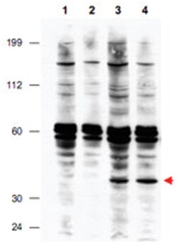 FANCF, Rabbit, Polyclonal Antibody, Abnova 100&mu;g; Unlabeled:Antibodies,