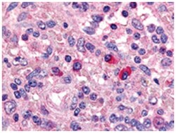 DCLRE1C, Goat, Polyclonal Antibody, Abnova 100&mu;g; Unlabeled:Antibodies,