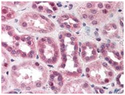 CUL5, Rabbit, Polyclonal Antibody, Abnova 100&mu;L; Unlabeled:Antibodies,