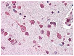 CUL7, Rabbit, Polyclonal Antibody, Abnova 100 &mu;L | Buy Online | Abnova | Fisher Scientific