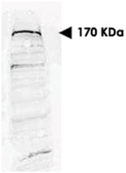 SETDB1 Rabbit anti-Human, Polyclonal Antibody, Abnova 100&mu;g; Unlabeled:Antibodies,