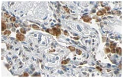 FANCG Rabbit anti-Chimpanzee, Human, Polyclonal Antibody, Abnova 100&mu;g;