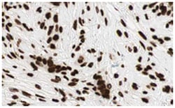 GLI2, Rabbit, Polyclonal Antibody, Abnova 100&mu;g; Unlabeled:Antibodies,