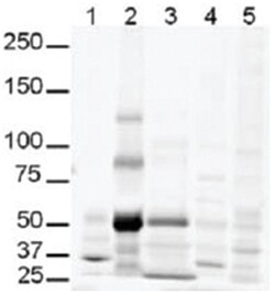 GLI3, Rabbit, Polyclonal Antibody, Abnova 100 &mu;g | Buy Online | Abnova Corporation | Fisher Scientific