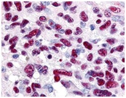 GLI3, Rabbit, Polyclonal Antibody, Abnova 100 &mu;g | Buy Online | Abnova Corporation | Fisher Scientific