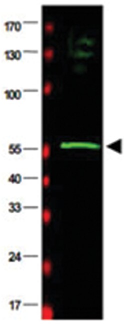 RAD23B, Goat, Polyclonal Antibody, Abnova 100&mu;g; Unlabeled:Antibodies,