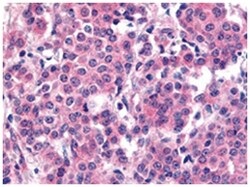 PLK1 (phospho T210), Rabbit, Polyclonal Antibody, Abnova 100&mu;g; Unlabeled:Antibodies,