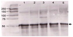 Angpt1, Rabbit, Polyclonal Antibody, Abnova 200&mu;L; Unlabeled:Antibodies,