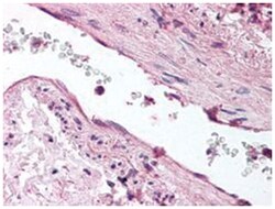 Angpt1, Rabbit, Polyclonal Antibody, Abnova 200&mu;L; Unlabeled:Antibodies,