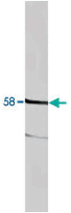 KCNA3 Rabbit anti-Human, Mouse, Rat, Polyclonal Antibody, Abnova 100&mu;g;