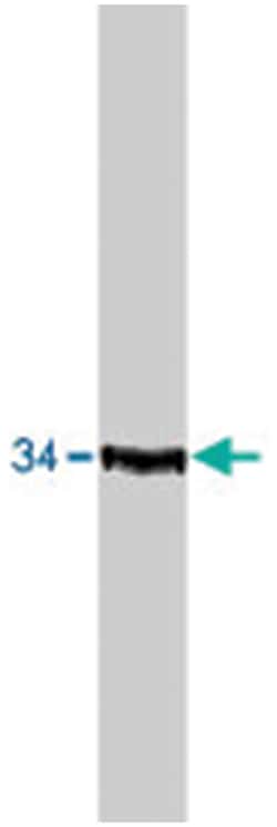 CDK2 (phospho), Rabbit anti-Human, Polyclonal Antibody, Abnova 20&mu;g;