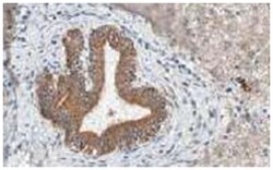 FBXO5, Rabbit, Polyclonal Antibody, Abnova 100 &mu;g | Buy Online | Abnova | Fisher Scientific