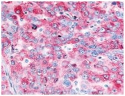 EGFR Rabbit anti-Human, Mouse, Rat, Polyclonal Antibody, Abnova 250 &mu;L | Buy Online | Abnova | Fisher Scientific