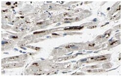 PPP1R13L, Rabbit, Polyclonal Antibody, Abnova 100&mu;g; Unlabeled:Antibodies,
