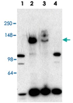 NCOA3, Rabbit, Polyclonal Antibody, Abnova 100 &mu;g | Buy Online | Abnova | Fisher Scientific
