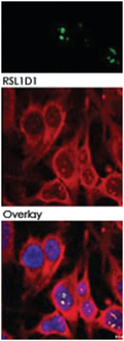 RSL1D1, Rabbit, Polyclonal Antibody, Abnova 100&mu;g; Unlabeled:Antibodies,