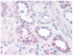 RELA (phospho S536), Rabbit anti-Human, Mouse, Rat, Polyclonal Antibody, Abnova 100 &mu;g | Buy Online | Abnova | Fisher Scientific